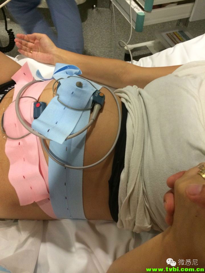 剖腹产全程拍摄，看完后震惊了！附澳洲生产经验(请转给需要的人) ...