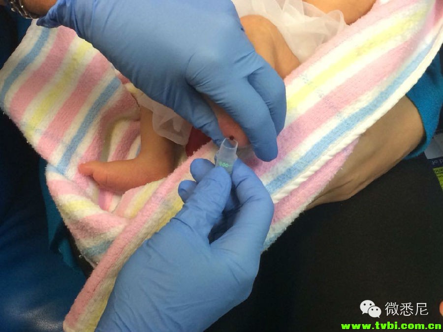 剖腹产全程拍摄，看完后震惊了！附澳洲生产经验(请转给需要的人) ...