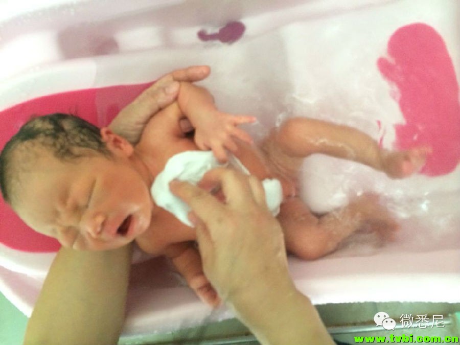 剖腹产全程拍摄，看完后震惊了！附澳洲生产经验(请转给需要的人) ...