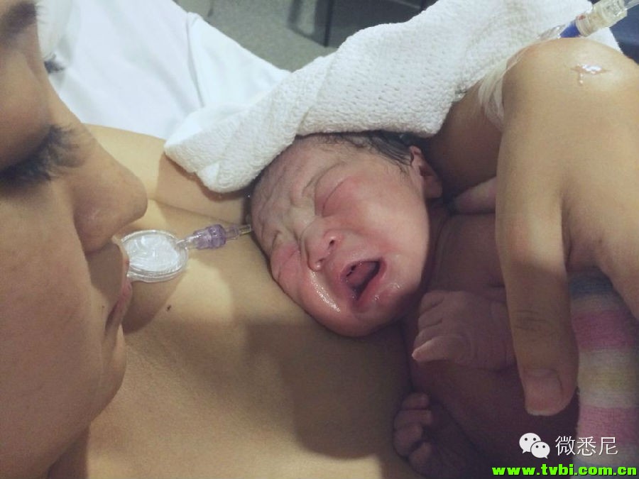 剖腹产全程拍摄，看完后震惊了！附澳洲生产经验(请转给需要的人) ...