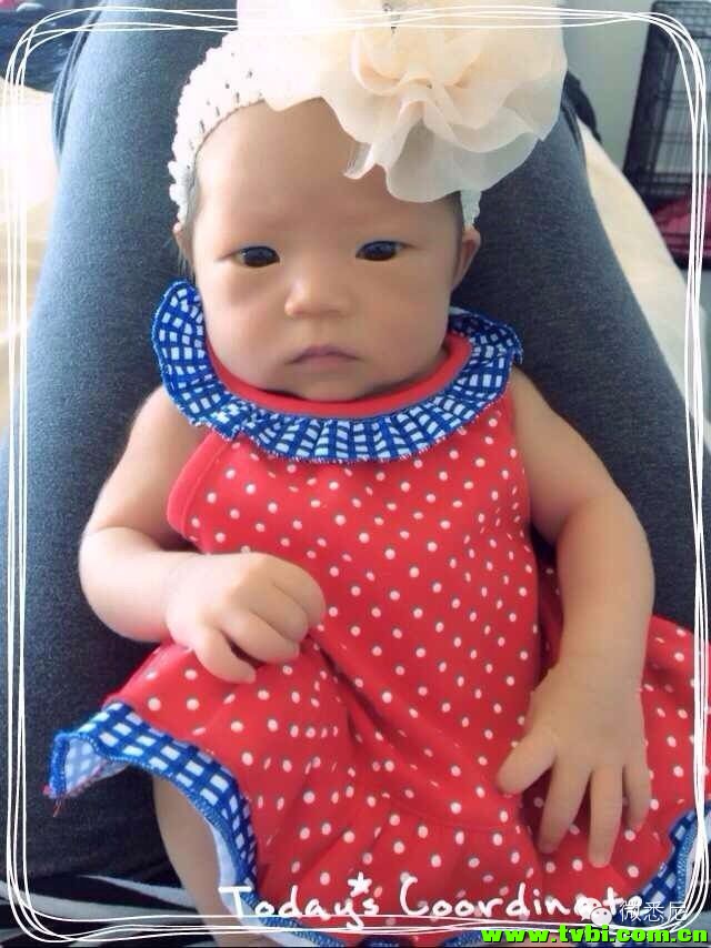 剖腹产全程拍摄，看完后震惊了！附澳洲生产经验(请转给需要的人) ...